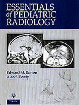 Burton |  Essentials of Pediatric Radiology | Buch |  Sack Fachmedien