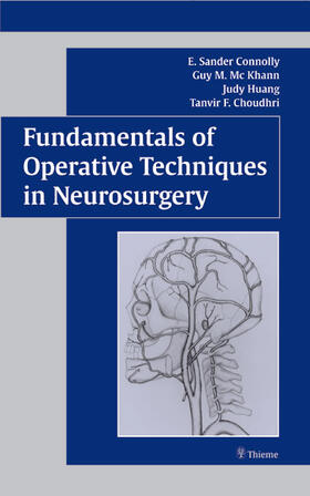 Edited by E. Sander Connolly |  Fundamentals of Operative Techniques in Neurosurgery | Buch |  Sack Fachmedien