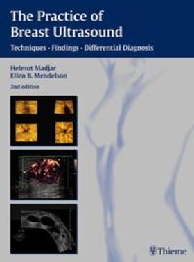 Madjar / Mendelson |  The Practice of Breast Ultrasound | Buch |  Sack Fachmedien
