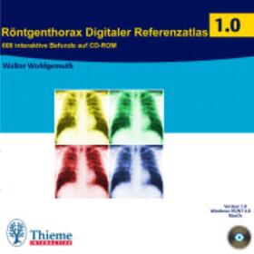 Wohlgemuth |  Röntgenthorax Digitaler Referenzatlas | Sonstiges |  Sack Fachmedien