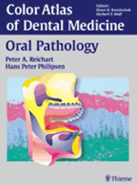 Reichart / Philipsen |  Oral Pathology | Buch |  Sack Fachmedien