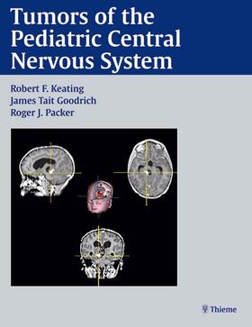 Robert Keating |  Tumors of the Pediatric Central Nervous System | Buch |  Sack Fachmedien