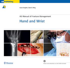 Jupiter / Ring |  AO Manual of Fracture Management - Hand and Wrist | Buch |  Sack Fachmedien