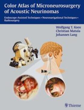 Koos / Matula / Lang |  Color Atlas of Microsurgery of Acoustic Neurinomas | Buch |  Sack Fachmedien