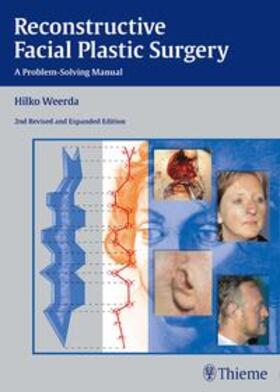 Weerda |  Reconstructive Facial Plastic Surgery | Buch |  Sack Fachmedien