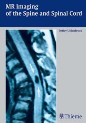 Uhlenbrock |  MR  Imaging of the Spine and Spinal Cord | Buch |  Sack Fachmedien