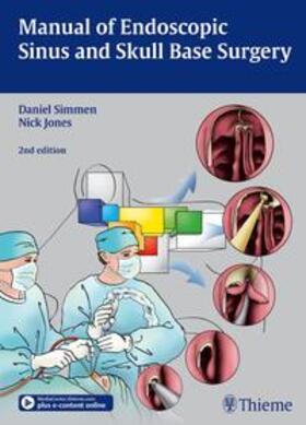 Simmen / Jones |  Manual of Endoscopic Sinus and Skull Base Surgery | Buch |  Sack Fachmedien