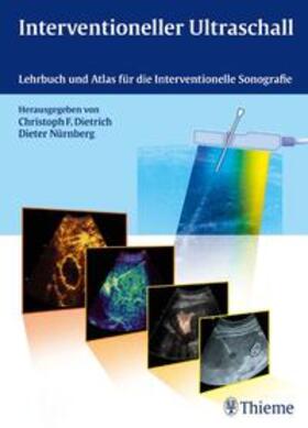 Dietrich / Nürnberg |  Interventioneller Ultraschall | Buch |  Sack Fachmedien