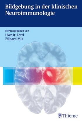 Mix / Zettl |  Bildgebung in der klinischen Neuroimmunologie | Buch |  Sack Fachmedien