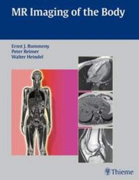 Rummeny / Reimer / Heindel |  Whole Body MRI Imaging | Buch |  Sack Fachmedien