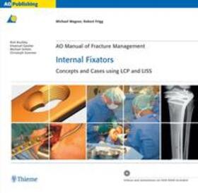 Wagner / Frigg |  AO Manual of Fracture Management: Internal Fixators | Buch |  Sack Fachmedien
