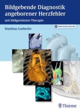 Gutberlet |  Bildgebende Diagnostik angeborener Herzfehler | Buch |  Sack Fachmedien