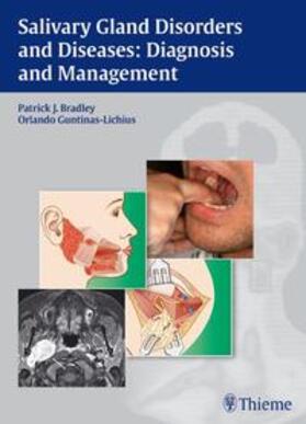 Bradley / Guntinas-Lichius |  Bradley, P: Salivary Gland Disorders and Diseases | Buch |  Sack Fachmedien