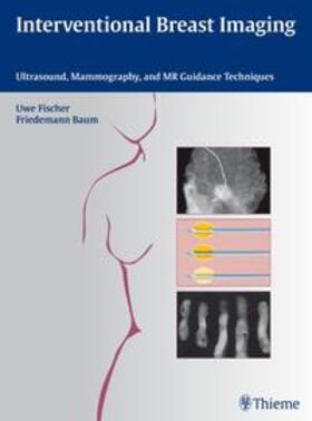 Baum / Fischer |  Interventional Breast Imaging | Buch |  Sack Fachmedien