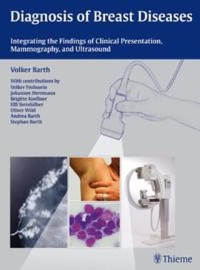 Barth |  Diagnosis of Breast Diseases | eBook | Sack Fachmedien