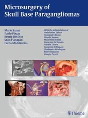 Piazza / Sanna / Shin |  Microsurgery of Skull Base Paragangliomas | eBook | Sack Fachmedien