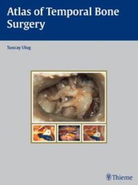 Ulug |  Atlas of Temporal Bone Surgery | Buch |  Sack Fachmedien