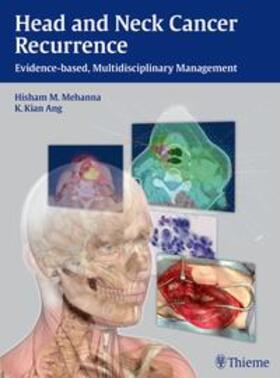 Mehanna / Ang |  Head and Neck Cancer Recurrence | Buch |  Sack Fachmedien