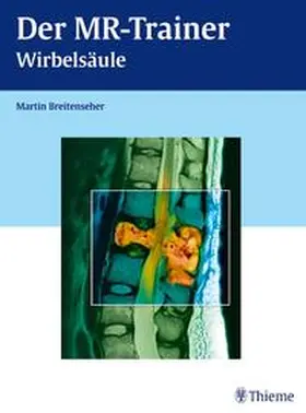 Breitenseher |  Der MR-Trainer Wirbelsäule | Buch |  Sack Fachmedien