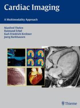 Barkhausen / Thelen / Erbel |  Cardiac Imaging | Buch |  Sack Fachmedien