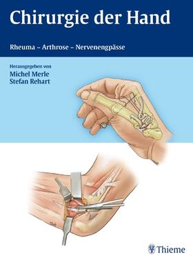 Merle / Rehart |  Chirurgie der Hand | Buch |  Sack Fachmedien