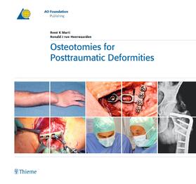 Marti / van Heerwaarden |  Osteotomies for Posttraumatic Deformities | Buch |  Sack Fachmedien