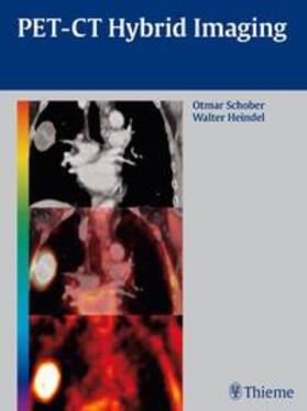 Schober / Heindel |  PET-CT Hybrid Imaging | Buch |  Sack Fachmedien