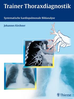 Kirchner |  Trainer Thoraxdiagnostik | Buch |  Sack Fachmedien