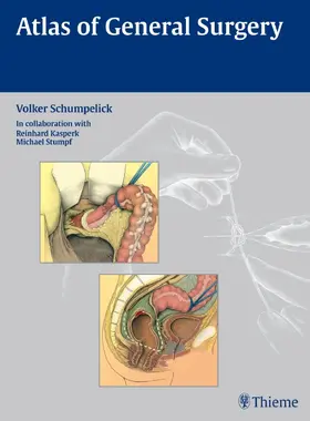 Schumpelick |  Atlas of General  Surgery | eBook | Sack Fachmedien