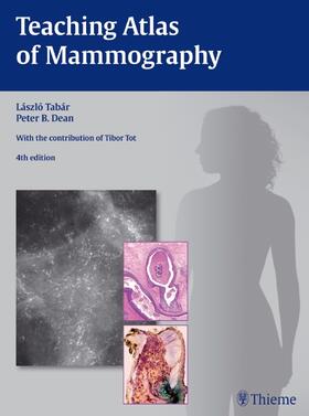 Dean / Tabar |  Teaching Atlas of Mammography | eBook | Sack Fachmedien