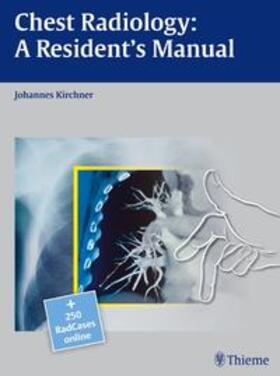 Kirchner |  Chest Radiology: A Resident's Manual | Buch |  Sack Fachmedien