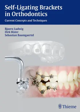 Ludwig / Bister / Baumgärtel |  Self-ligating Brackets in Orthodontics | Buch |  Sack Fachmedien