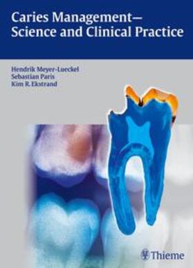 Meyer-Lückel / Paris / Ekstrand |  Caries Management - Science and Clinical Practice | Buch |  Sack Fachmedien