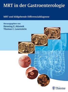 Adamek / Lauenstein |  MRT in der Gastroenterologie | eBook | Sack Fachmedien