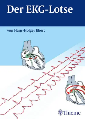 Ebert |  Der EKG-Lotse | eBook | Sack Fachmedien