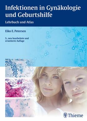 Petersen |  Infektionen in Gynäkologie und Geburtshilfe | eBook | Sack Fachmedien