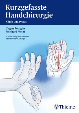 Rudigier / Meier |  Kurzgefasste Handchirurgie | eBook | Sack Fachmedien