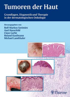 Garbe / Szeimies / Hauschild |  Tumoren der Haut | eBook | Sack Fachmedien