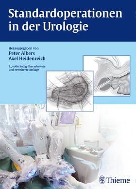 Albers / Iburg / Heidenreich |  Standardoperationen in der Urologie | eBook | Sack Fachmedien