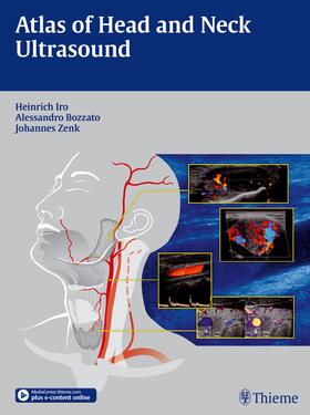 Iro / Bozzato / Zenk |  Atlas of Head and Neck Ultrasound | Buch |  Sack Fachmedien