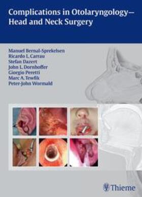 Bernal-Sprekelsen / Carrau / Dazert |  Complications in Otolaryngology - Head and Neck Surgery | Buch |  Sack Fachmedien