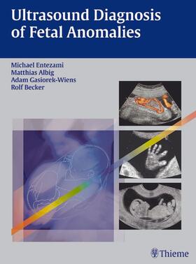 Entezami / Albig / Becker |  Ultrasound Diagnosis of Fetal Anomalies | eBook | Sack Fachmedien