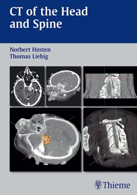 Hosten / Liebig |  CT of the Head and Spine | eBook | Sack Fachmedien