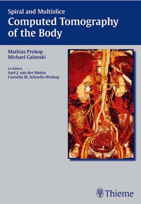 Prokop / Galanski |  Spiral and Multislice Computed Tomography of the Body | eBook | Sack Fachmedien