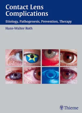 Roth |  Contact Lens Complications | eBook | Sack Fachmedien