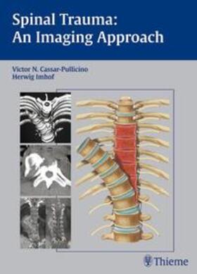 Cassar-Pullicino / Imhof |  Spinal Trauma - An Imaging Approach | eBook | Sack Fachmedien