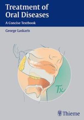 Laskaris |  Treatment of Oral Diseases | eBook | Sack Fachmedien