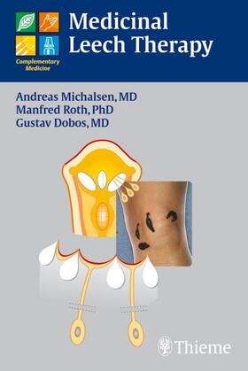 Michalsen / Dobos / Roth |  Medicinal Leech Therapy | eBook | Sack Fachmedien