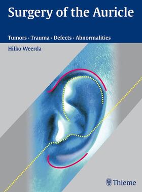 Weerda |  Surgery of the Auricle | eBook | Sack Fachmedien