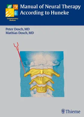 Dosch |  Manual of Neural Therapy According to Huneke | eBook | Sack Fachmedien